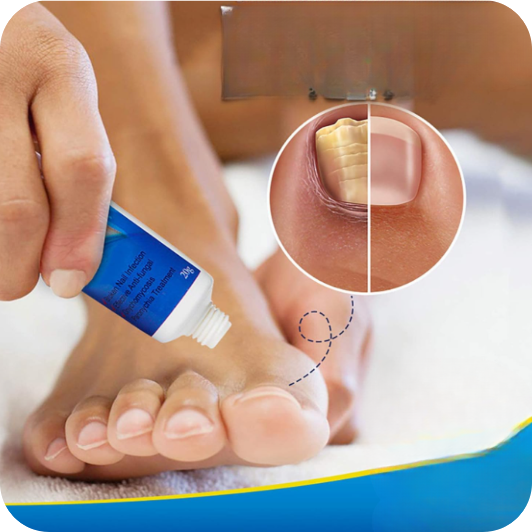 Fungus Pro® Crema Anti Hongos para los Pies