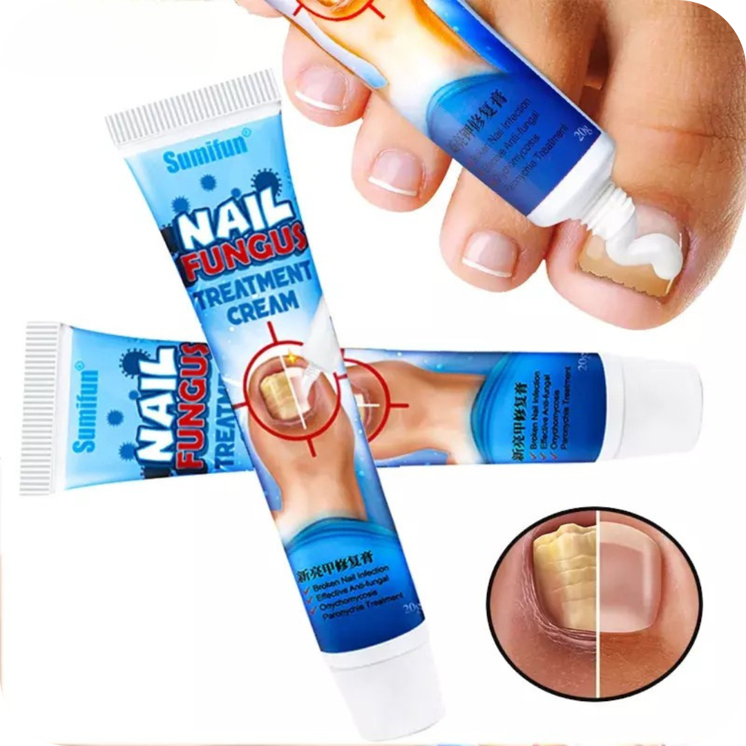 Fungus Pro® Crema Anti Hongos para los Pies
