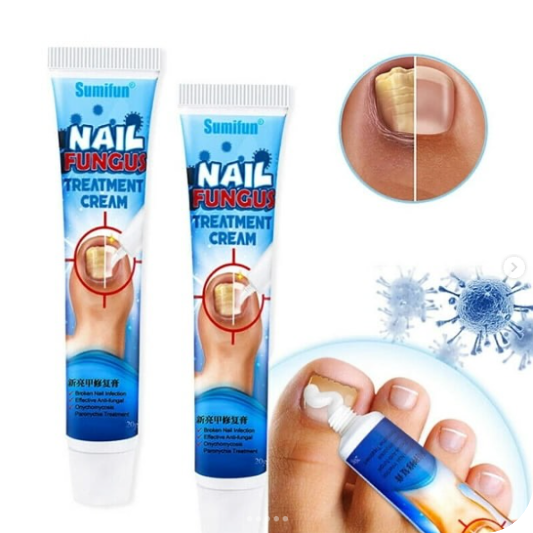Fungus Pro® Crema Anti Hongos para los Pies