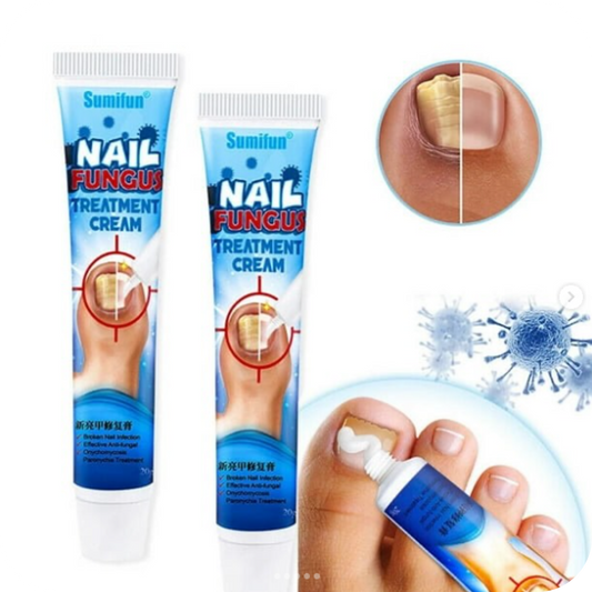 Fungus Pro® Crema Anti Hongos para los Pies
