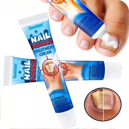 Fungus Pro® Crema Anti Hongos para los Pies