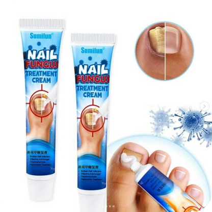 Fungus Pro® Crema Anti Hongos para los Pies